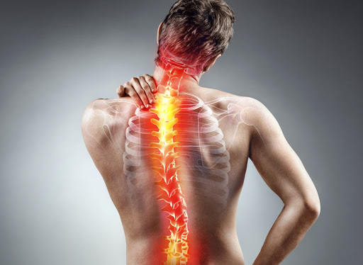 Mal di schiena: cos’è, sintomi e rimedi naturali