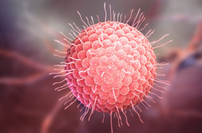 virus Herpes Zoster