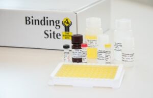 Verso il vaccino per il COVID-19: l’azienda The Binding Site lancia il nuovo test sierologico