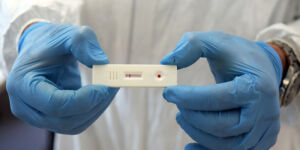 Covid-19, qual è la differenza tra test sierologico e test antigenico?