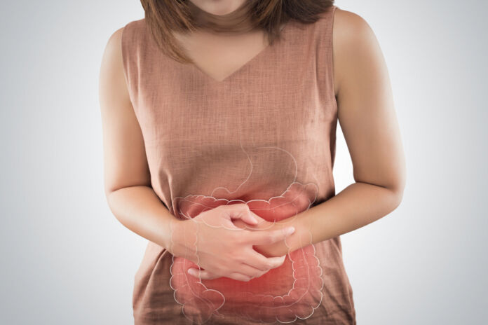 Tumore dell'intestino
