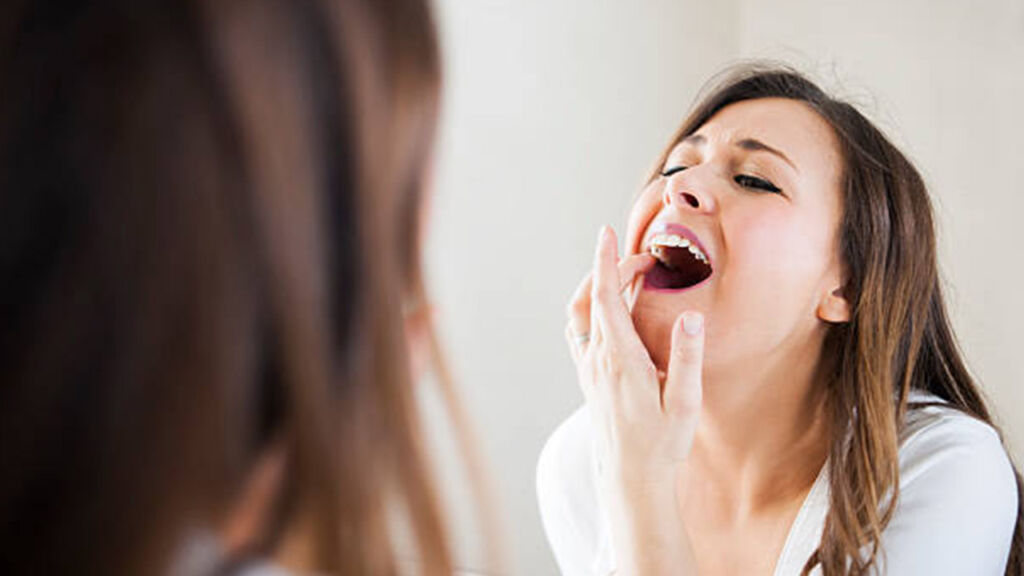 Carie dentale: cos’è, cause, come riconoscerla, prevenzione e cura
