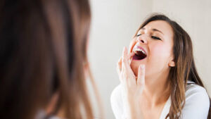 Carie dentale: cos’è, cause, come riconoscerla, prevenzione e cura
