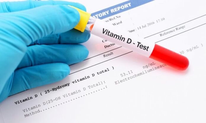 vitamina d coronavirus