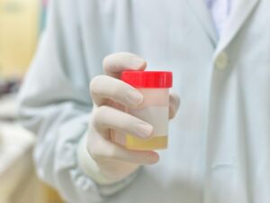 Cosa fare in caso di sangue nelle urine?