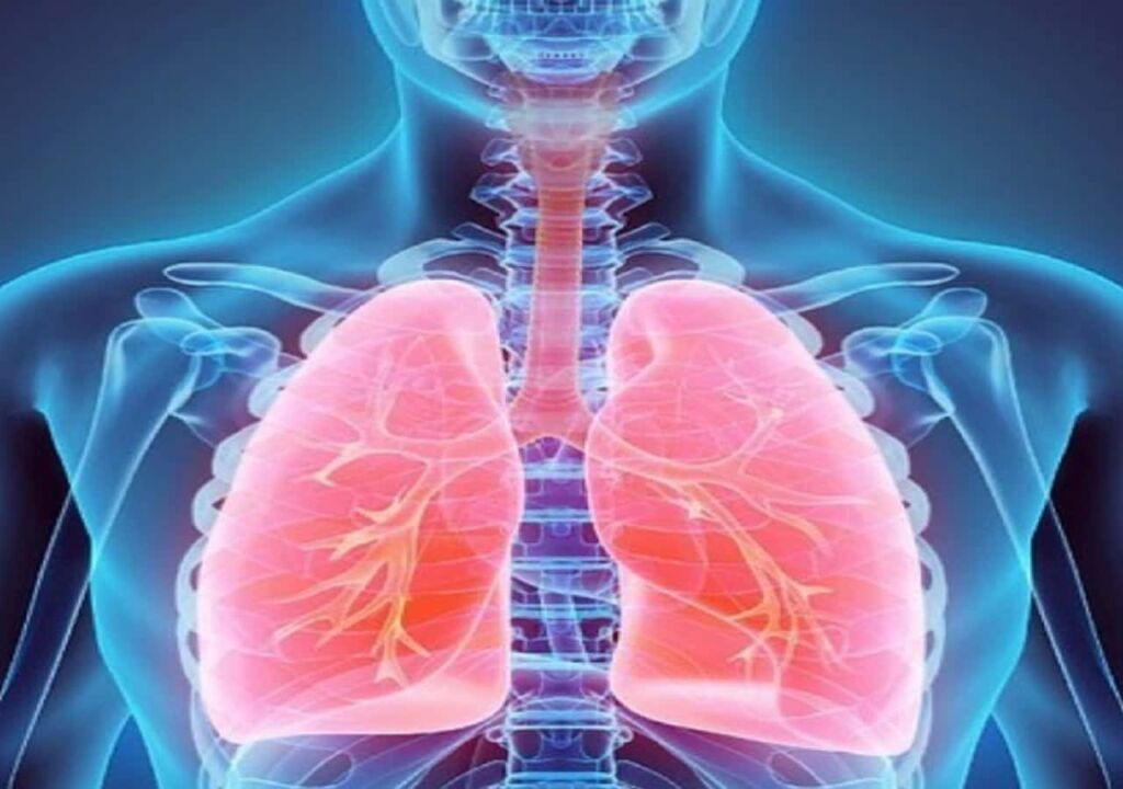Tumore al polmone: sopravvivenza e fattori chiave da conoscere