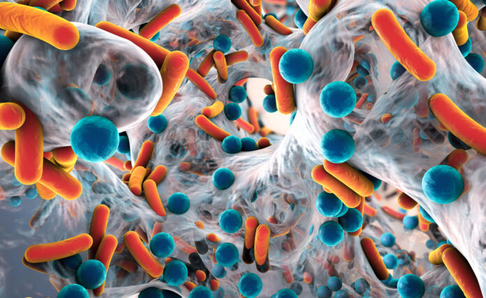 infezione virale batterica