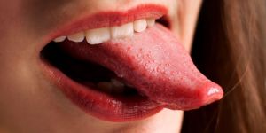 Scottatura sulla lingua? 5 rimedi naturali che funzionano