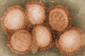 “Perché il virus H5N8 può essere pericoloso per gli uomini”