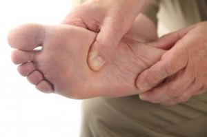 Ulcere nel piede diabetico, sintomi, cause e trattamento