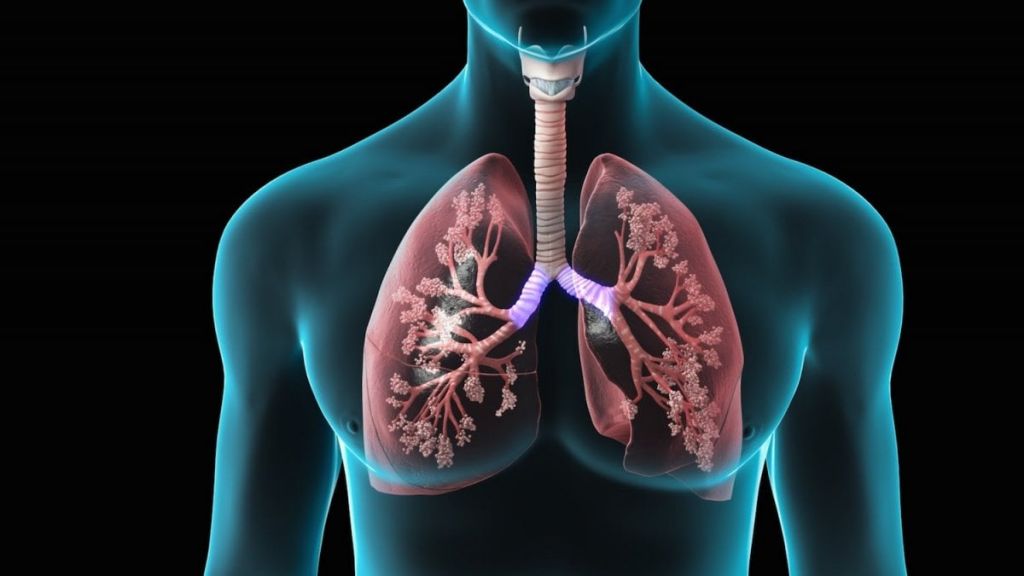 Grave polmonite di origine sconosciuta fa tre morti