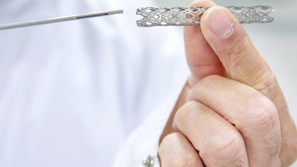 Stent: cos’è, a cosa serve, le caratteristiche