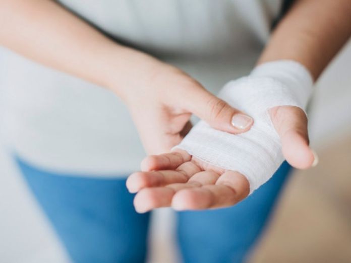 come medicare ustione a casa