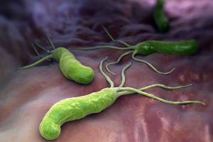 I 9 sintomi dell’infezione da Helicobacter