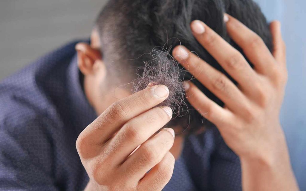 Alopecia, approvato farmaco per far ricrescere i capelli, come funziona