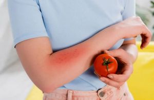 Nuovo virus: influenza del pomodoro, di cosa si tratta?
