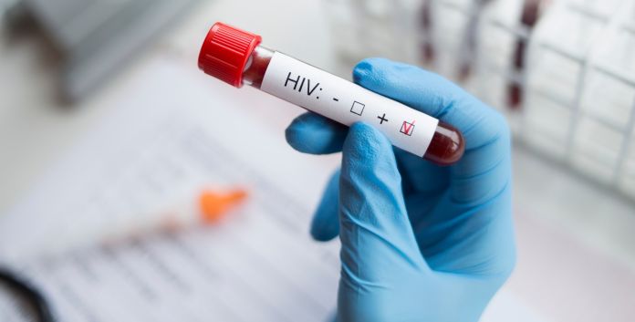 sintomi hiv