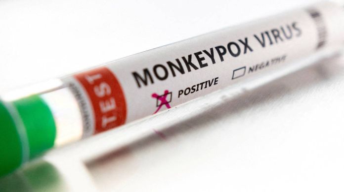 vaiolo scimmie monkeypox