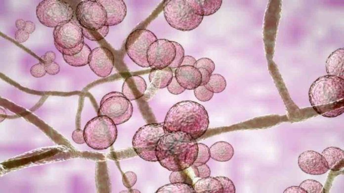 candida auris