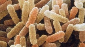 Listeria, morto ad Alessandria, “ha mangiato wurstel crudi”