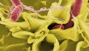 Salmonella: quali sono i sintomi?