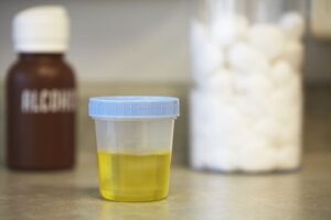 Pus nelle urine: cause e sintomi della piuria