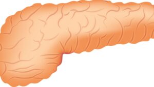 Tumore al pancreas: si può guarire?