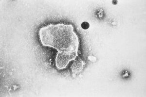 Virus sinciziale, l’allarme: “Siamo in piena pandemia”