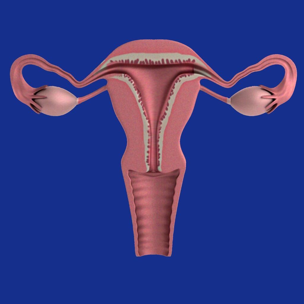 endometriosi