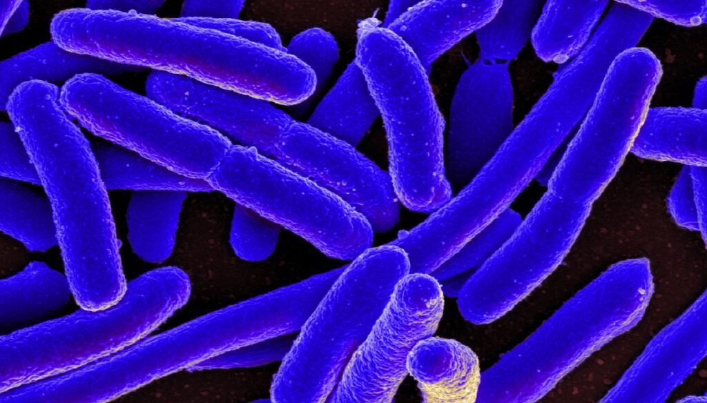 Soffri di cistite da Escherichia Coli? I rimedi per stare meglio