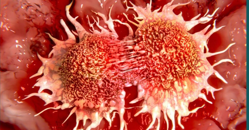 Cosa causa il neuroblastoma? Scoperti i fattori genetici