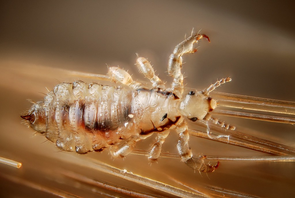 I pidocchi nascono dalla sporcizia?