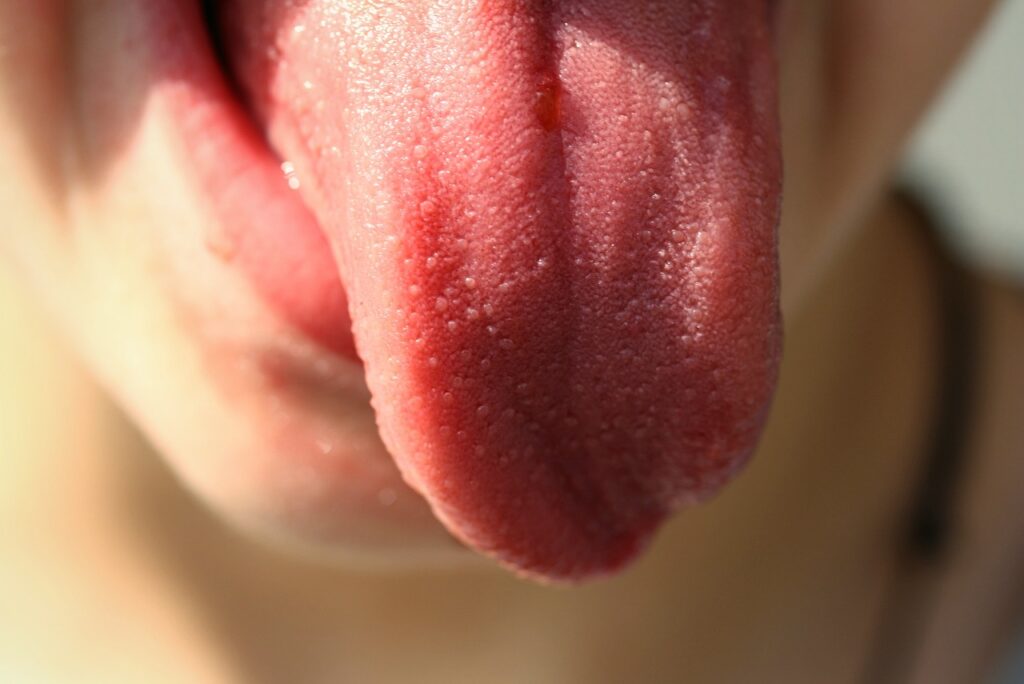 bolle sulla lingua