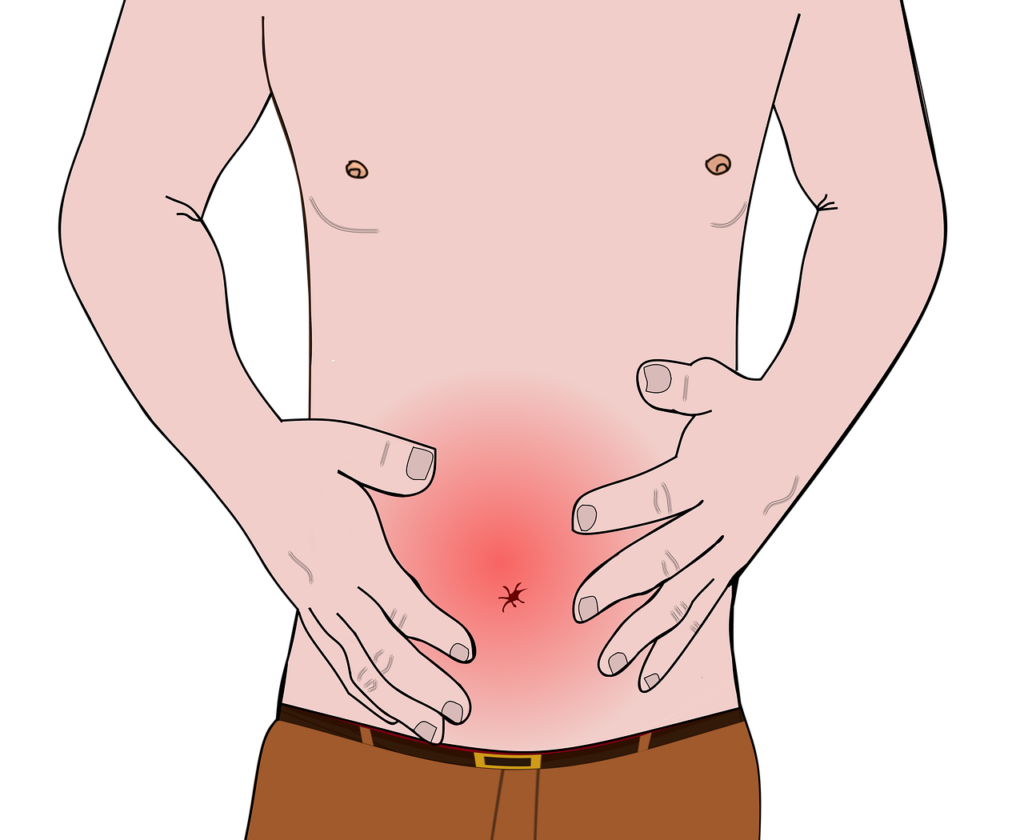 diverticoli infiammati