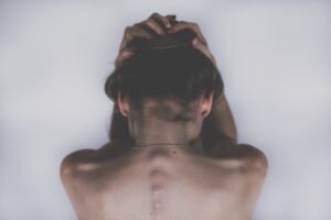 Lupus: quali sono i sintomi iniziali e come si tratta la malattia?