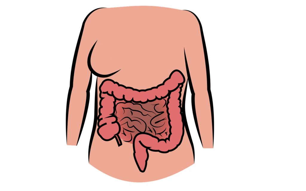 diverticoli