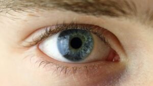 Glaucoma: i segnali d'allarme da conoscere.