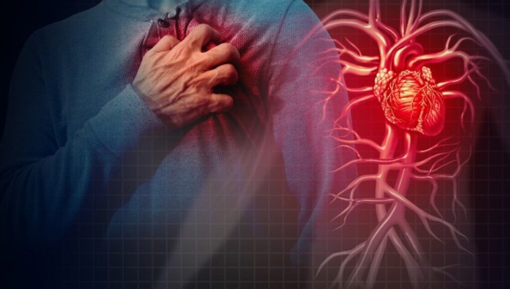 Pressione alta: quando può causare l'infarto?