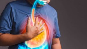 Reflusso gastroesofageo: sintomi, cause e fattori di rischio