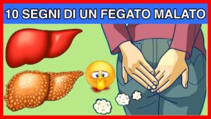 I 10 segnali che il tuo fegato è in sofferenza! Non tutti li conoscono