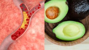 Avocado: ecco perché questo super alimento deve far parte della tua dieta