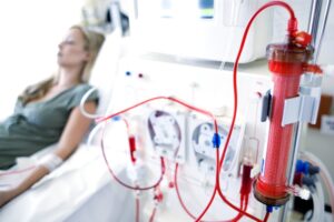 Dialisi: il trattamento per curare l’insufficienza renale