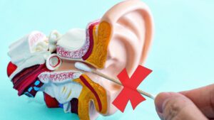 Non usare mai questo strumento per pulire le orecchie: è molto pericoloso