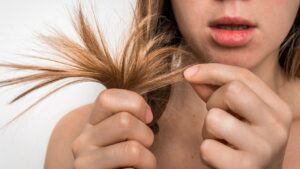 Capelli secchi e fragili: potrebbe essere un segnale d’allarme per la tua salute?