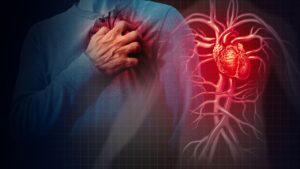Quali sono i segni di un attacco di cuore?