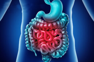 Diverticoli infiammati: quali sono i sintomi a cui prestare attenzione?