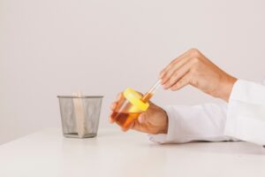 Cosa significa se hai i nitriti nelle urine?