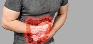 Colon irritabile: quali sono i sintomi iniziali?