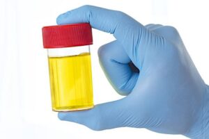 Sangue nell’urina: quando preoccuparsi?