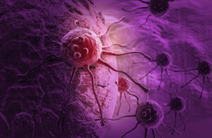 Quali sono i tumori più letali, i fattori di rischio e la prevenzione